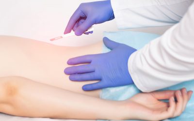 What You Need to Know About Spinal Fusion Surgery